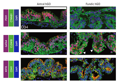 These confocal micrographs show how β-catenin activation promotes fundus development from human foregut progenitor spheroids. Both antral and fundic organoids (hGOs) contained epithelium that expressed CDH1, KRT8 and CTNNB1, as well as gastric markers GATA4 and CLDN18. The colors of the gene labels (left) correspond to the colors appearing in the slides.